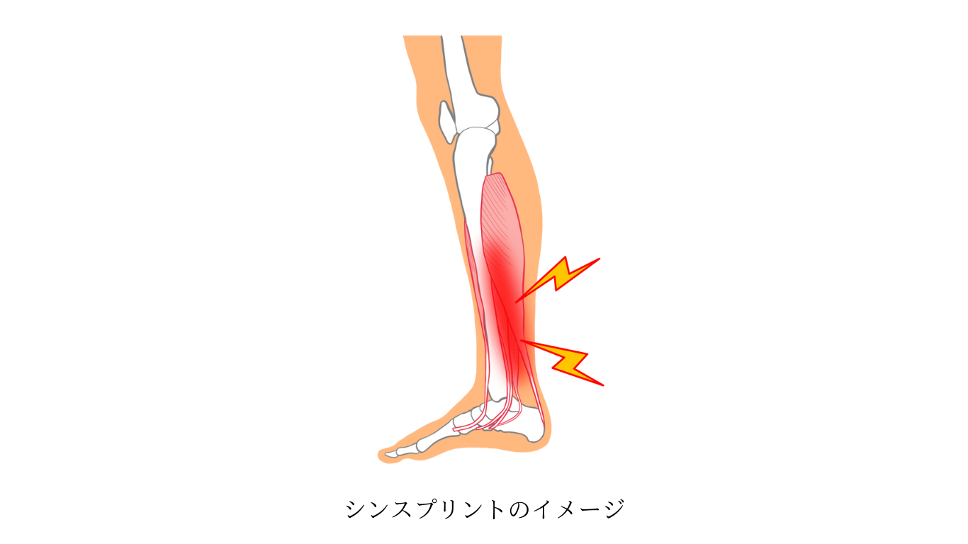 ダウンロード